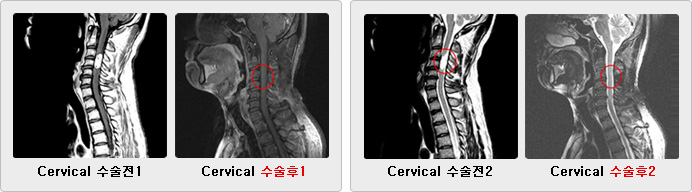 Cervical ġ ġĻ