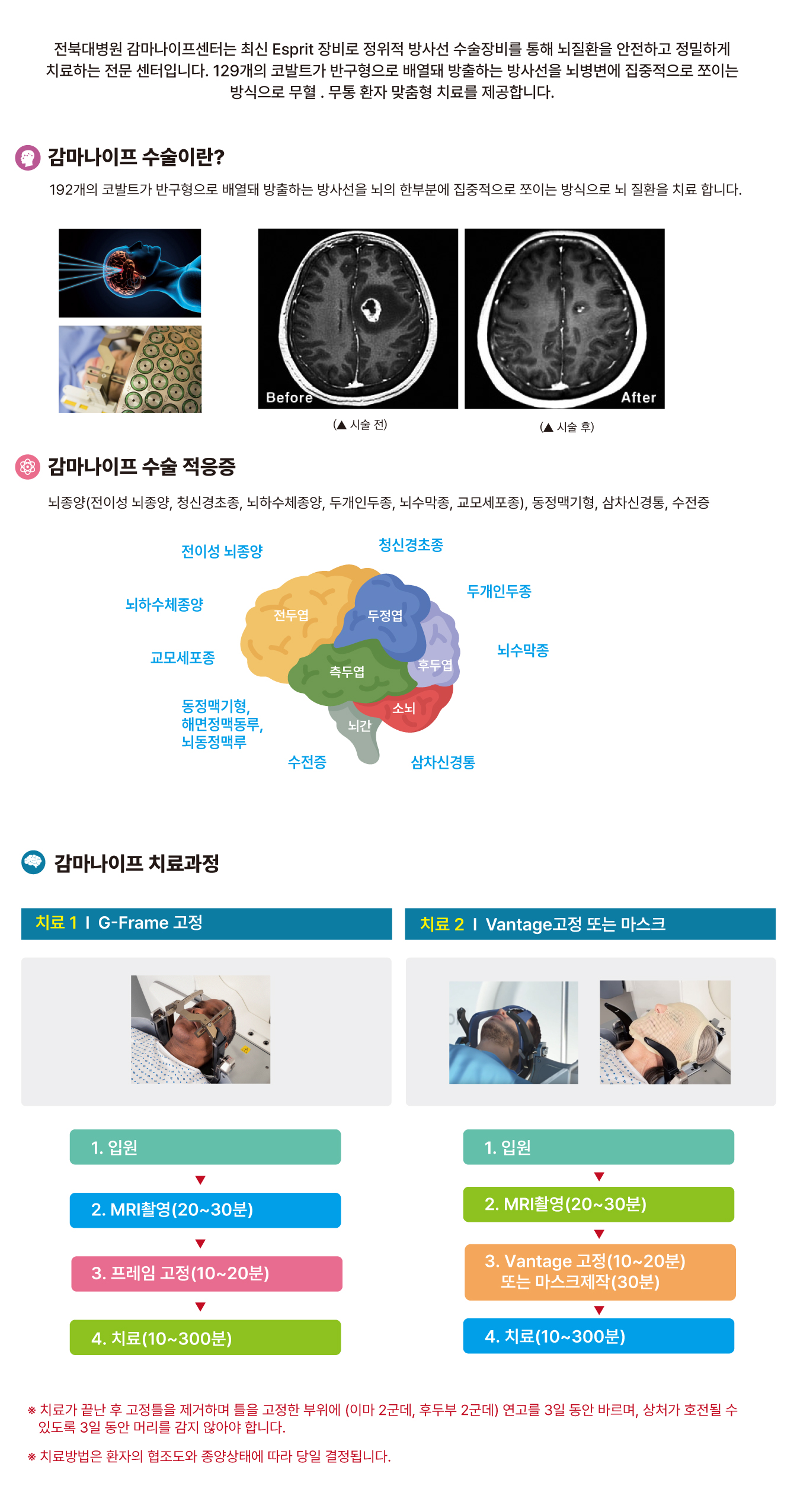 센터소개_감마나이프센터