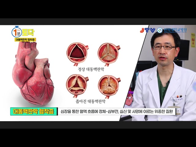 1분토닥_대동맥판막협착증.jpg