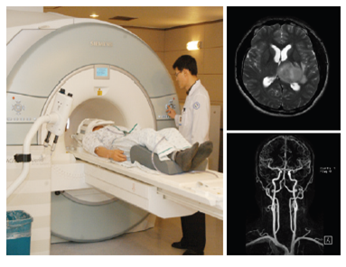 MRI+MRA